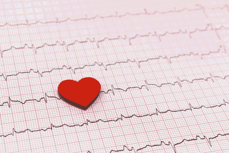 Holter EKG