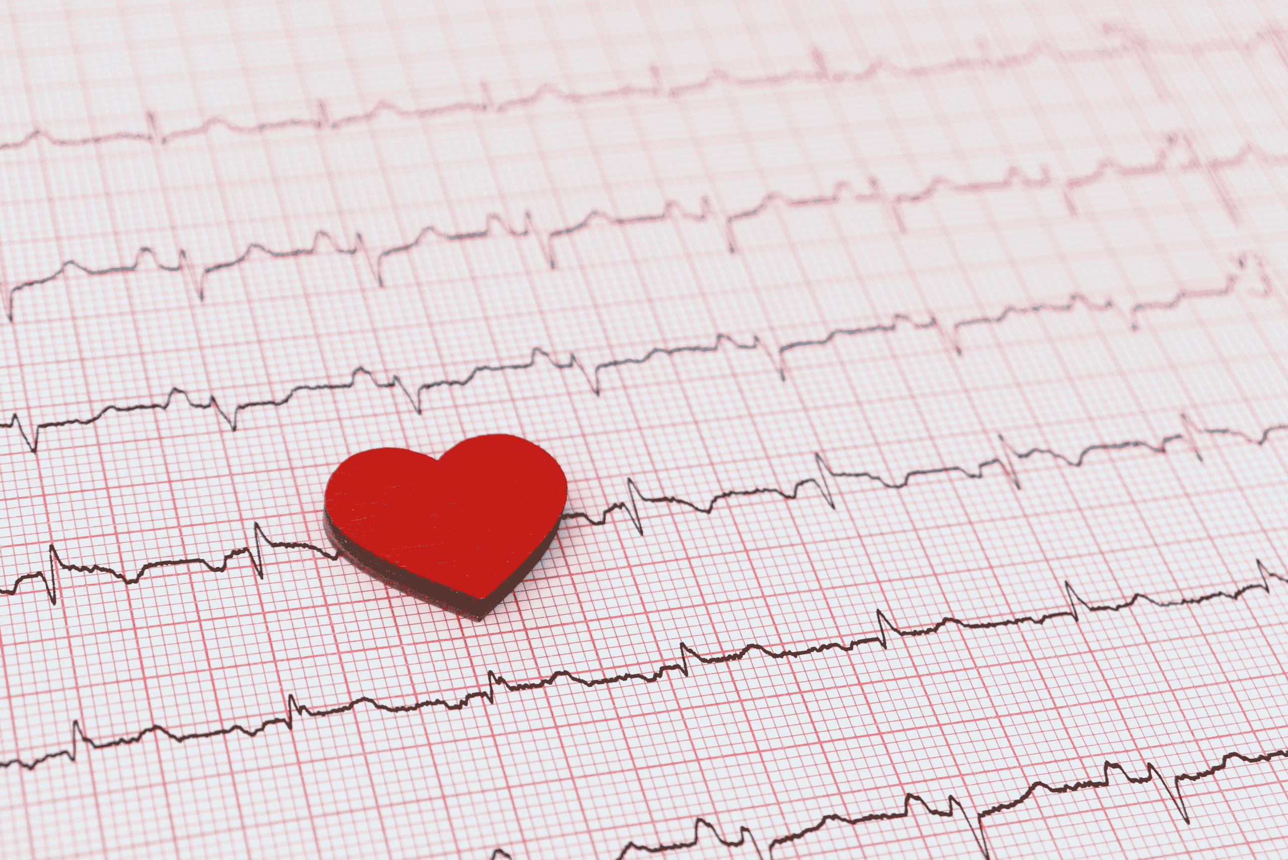 Holter EKG